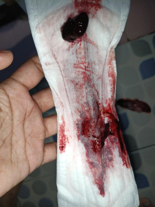week 6-7 mau nanya keluar bercak