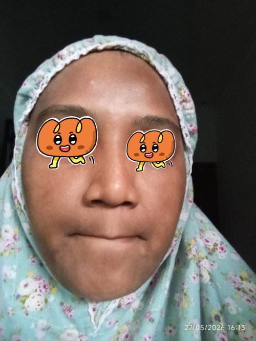 Krim pencerah buat kulit wajah