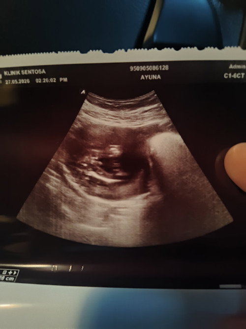 Hai mommy².. nak tanya laa.. ni baby boy or baby girl ya? Doc kata baby boy😆