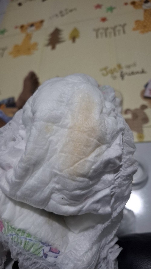 Pipis bayi 8 bulan