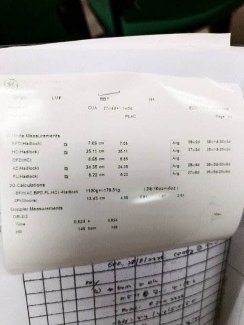 Berat baby dalam kandungan