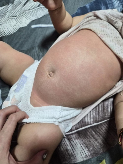 what is this rash about