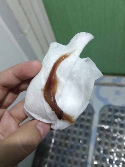 Mucosplug na po ba to?