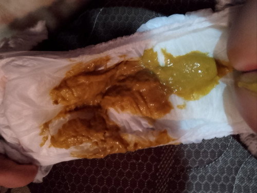 Bun apakah baby bunda juga mengalami alergi susu sapi