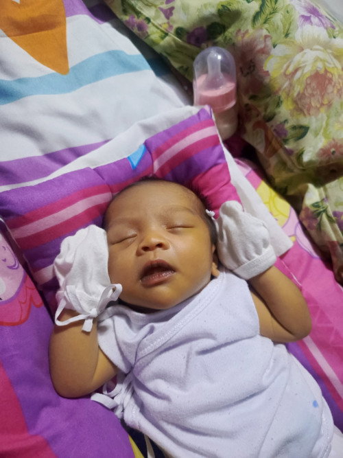 Newborn Jaundice