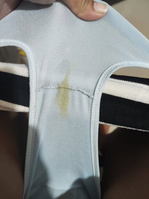 Vaginal discharge