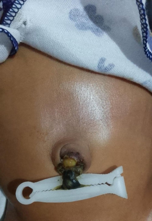 Mau tanya dong bund