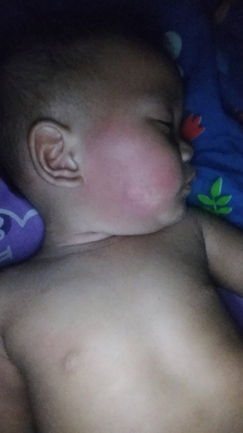 ใครมีประสบการณ์ลูกแพ้นมวัวมั้ยคะ