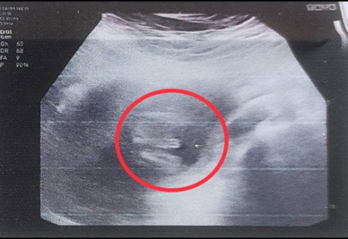 แบบนี้ไปทางลูกสาวหรือลูกชายมากกว่ากันคะแม่ๆ