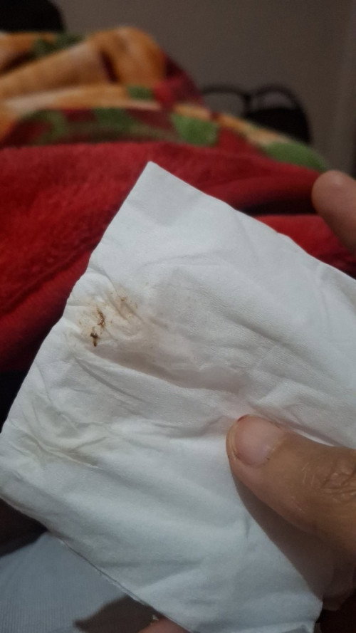 buu ibu ada yang pernah ngalamin flek coklat tanpa kram perut diusia 12 minggu?