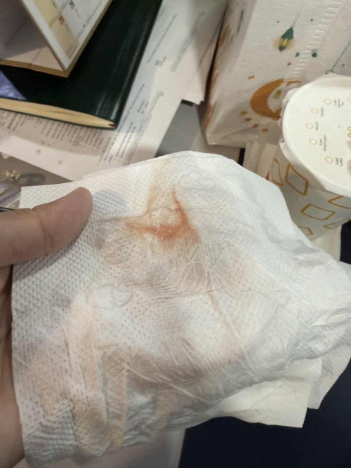 DARAH DI LENDIR SEMASA BUANG AIR KECIL