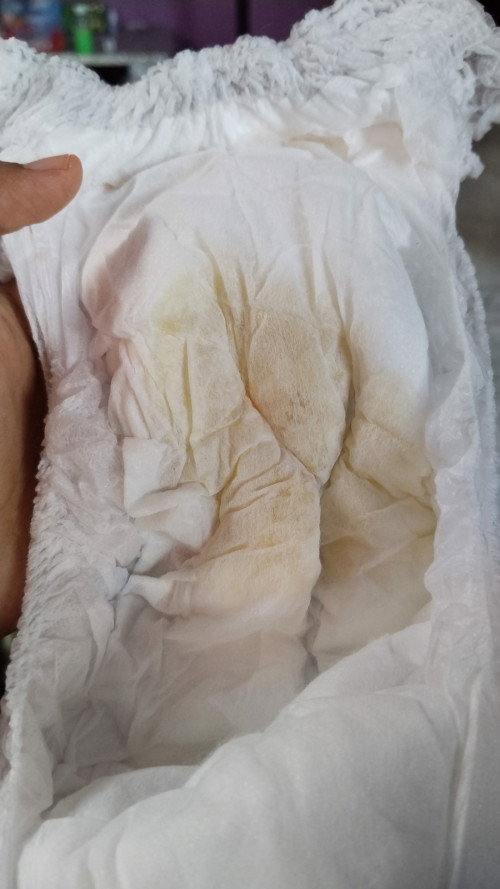 Bayi menolak dbf , terus ak skalian kasih sufor selang seling asi, tapi pipisnya jadi kaya sedikit