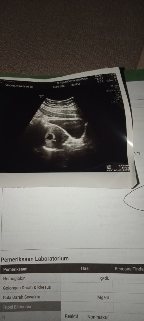 Jika hpl dokter tanggal 5 februari 2027 maka 4 bulan nya hari apa dan bulan berapa ya