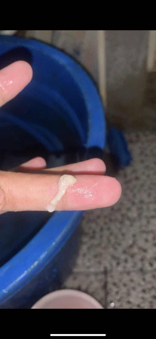 Hamil 39 week keluar kaya gini kenapa ya bun soalnya anak pertama belom tau apa”