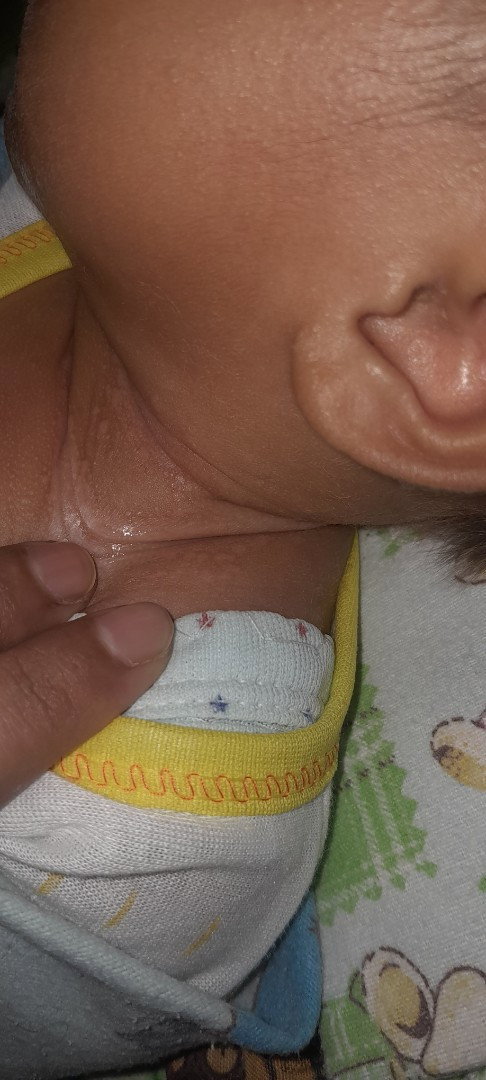 Kulit bayi