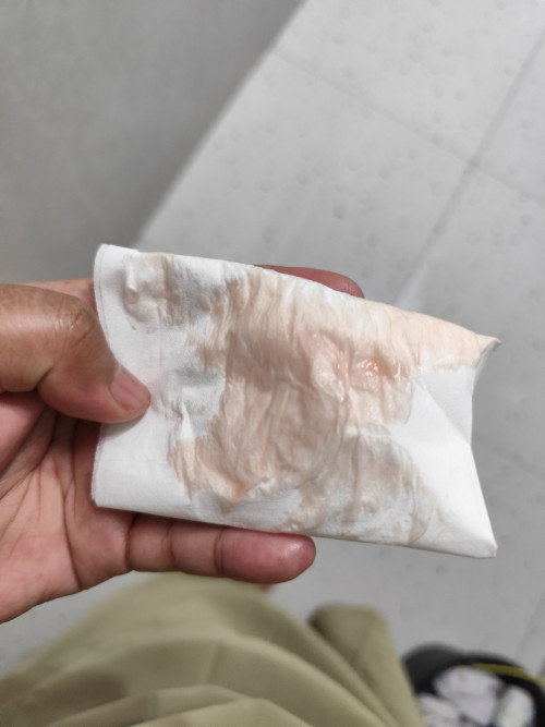 Flek pink tapi ngak sakit hanya kencang