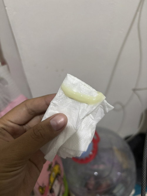 33 Week Keputihan Mengental