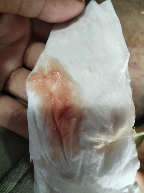 ออกเเบบนี้ อันตรายไหมค่ะ