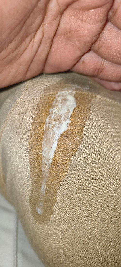 Ini kahak ke?