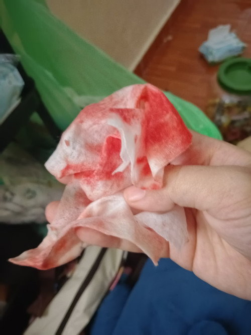 Ingin tahu darah 31 week 1 day