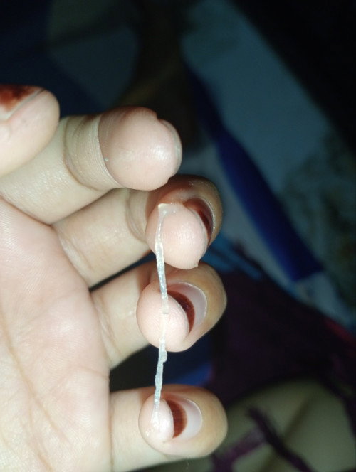Hamil trimester 1