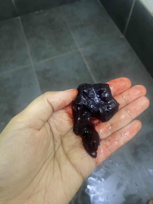 Darah Beku