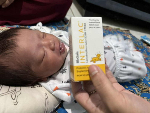 Bayi diare