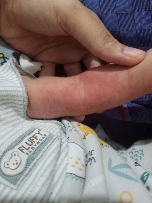 Bayi 9 hari