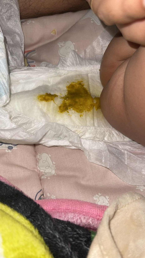 Diare pada anak 2 bulan