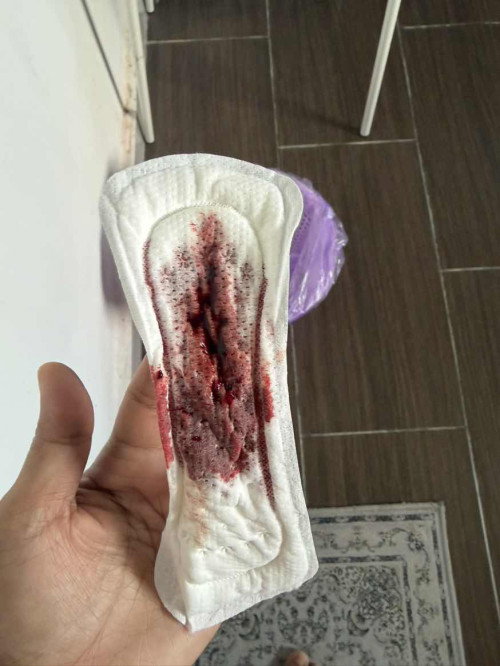 Bleeding, Sy dh tukar 3 pantyliner
Full blood, color merah gelap
Now feel dizzy, mommies pernah jd?