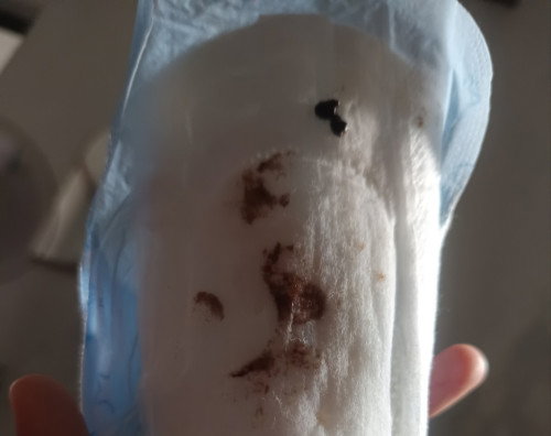 Maaf ada yang pernah alami kaya gini di usia 6 week gak bunda