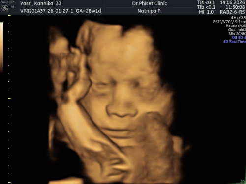 28 weeks 1 day
