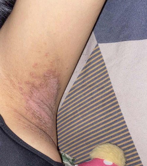 mau tanya dong bun
