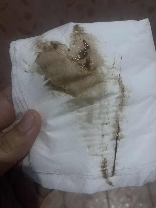Flek dan perut kram UK 6-7 minggu