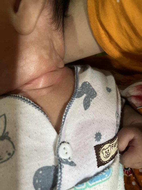 Bayi 2 bulan
