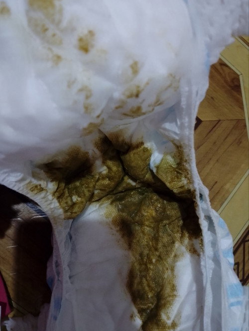 Poop ni baby