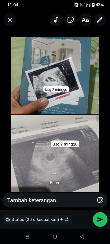 Usg 9 minggu tiba² hanya kantong padahal ga ada flek