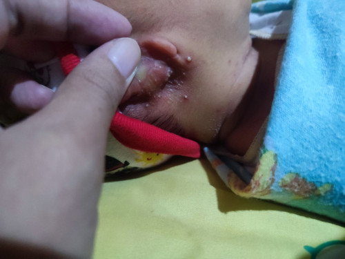 Tanya bun ini kenapa ya