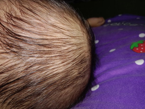 Kepala bayi