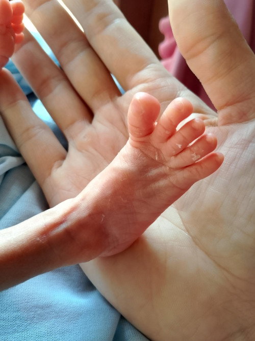 Pejuang NICU