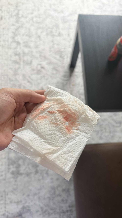 TURUN DARAH 37 MINGGU