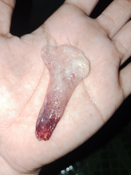 Pil KB telat haid 2minggu di tes negatif