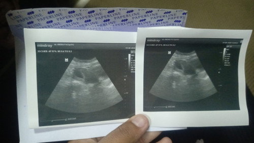 Hasil USG dokter 7 weks