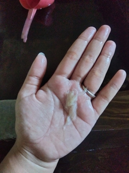 Keputihan kental seperti jelly