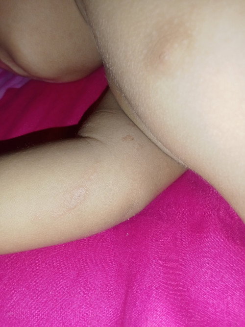 Solusi dong cari obat untuk kulit anak. apa ya kira ?