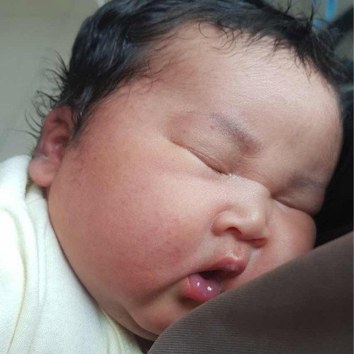 Bayi makrosomia