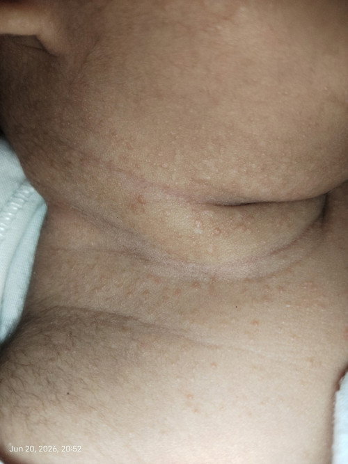 Neck Rash.............