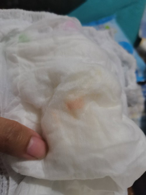 Pipis bayi