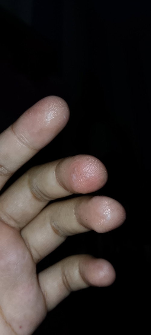Hamil 39minggu 2hari