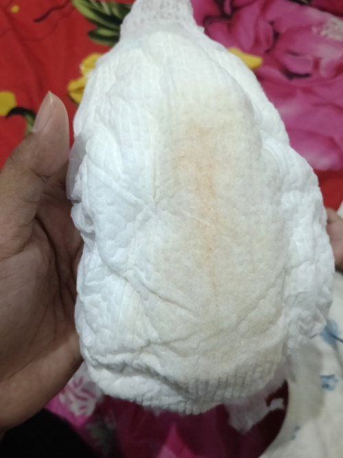 Pampers ada bercak Oren